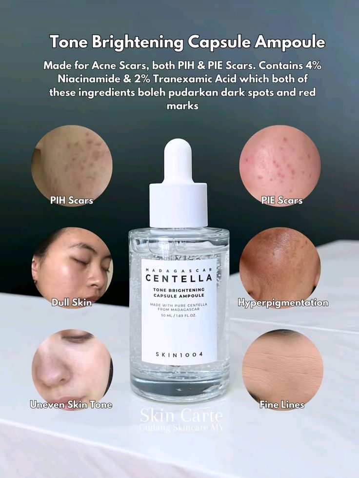 Centella Tone Brightening Capsule Ampoule